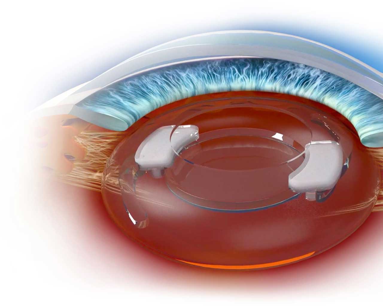 Figure 4. The SpyGlass system  (SpyGlass Pharma).