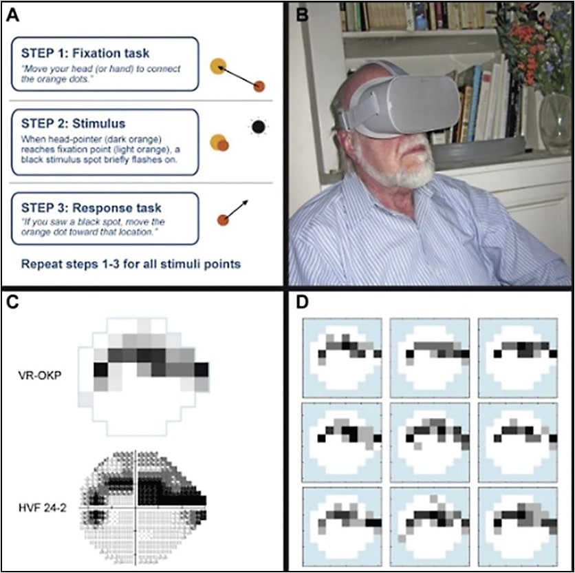 Figure 5. The Vivid Vision Perimeter testing software uses a dynamic fixation marker that changes location from trial to trial, and patients respond by moving their heads or a hand-held pointer in the direction of the seen targets.