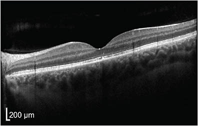 FIGURE 4