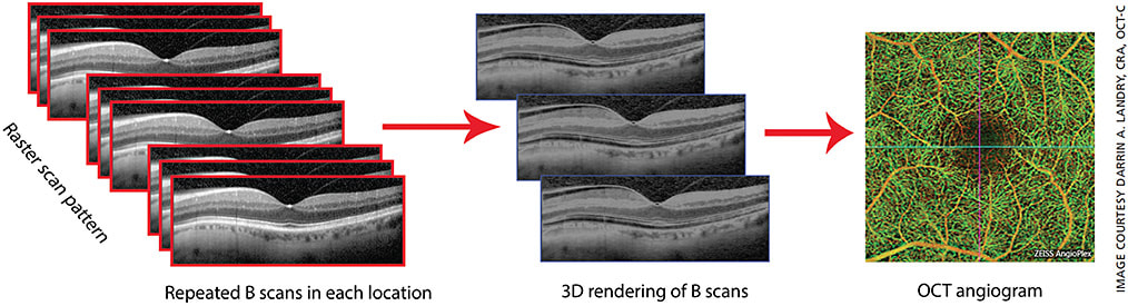 Figure 3. OCTA utilizes X, Y and Z axes to render three-dimensional OCT scans, which are evaluated by the software to detect movement.