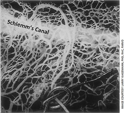 Figure 1. Dr. Ashton’s neoprene castings of the aqueous humor outflow pathway reveal a characteristic morphology comprised of a vascular network of interconnected linear segments surrounding the canal — both anteriorly into the outer limbus and posteriorly toward the trabecular meshwork.