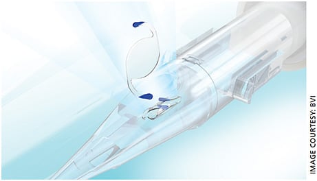 The IPure, BVI’s aspheric monofocal IOL, comes preloaded.