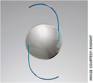 RxSight’s Light Adjustable Lens