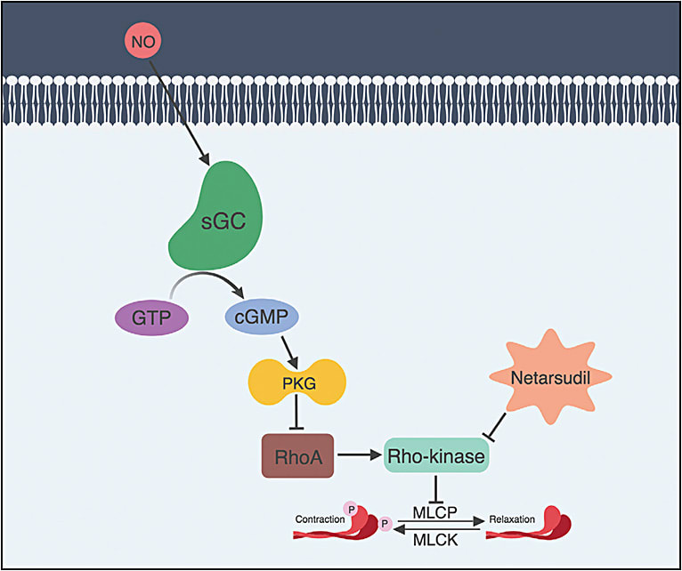 Figure 1. Netarsudil and nitric oxide (NO) promote cytoskeletal relaxation through their influence in Rho signaling cascade. Myosin and actin are key components of the cytoskeleton of muscle and nonmuscle cells. Phosphorylated myosin interacts with actin, increasing cell stiffness. Phosphorylation of myosin is regulated by the activity of myosin light chain kinase and myosin light chain phosphatase (MLCP).  Netarsudil inhibits Rho kinase and thereby interferes with its inhibitory effect on MLCP, an enzyme that dephosphorylates the regulatory light chain to induce relaxation. NO inactivates the Rho pathway upstream of Rho kinase. Binding of NO to soluble guanylate cyclase (sGC) results in increased conversion of guanosine triphosphate (GTP) to cyclic guanosine 3’5’-monophosphate (cGMP), which in turn activates cGMP-dependent protein kinase (PKG). Among the effects of activated PKG is the inhibition of the RhoA, a G-protein that activates Rho kinase. Diminished Rho kinase activation results in increased MLCP activity, thus contributing to cytoskeletal relaxation.
IMAGE COPYRIGHT ANGELO P. TANNA, MD; IMAGE CREATED USING BIORENDER.
