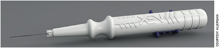 Allergan’s XEN Gel Stent is designed to decrease IOP in patients with POAG.