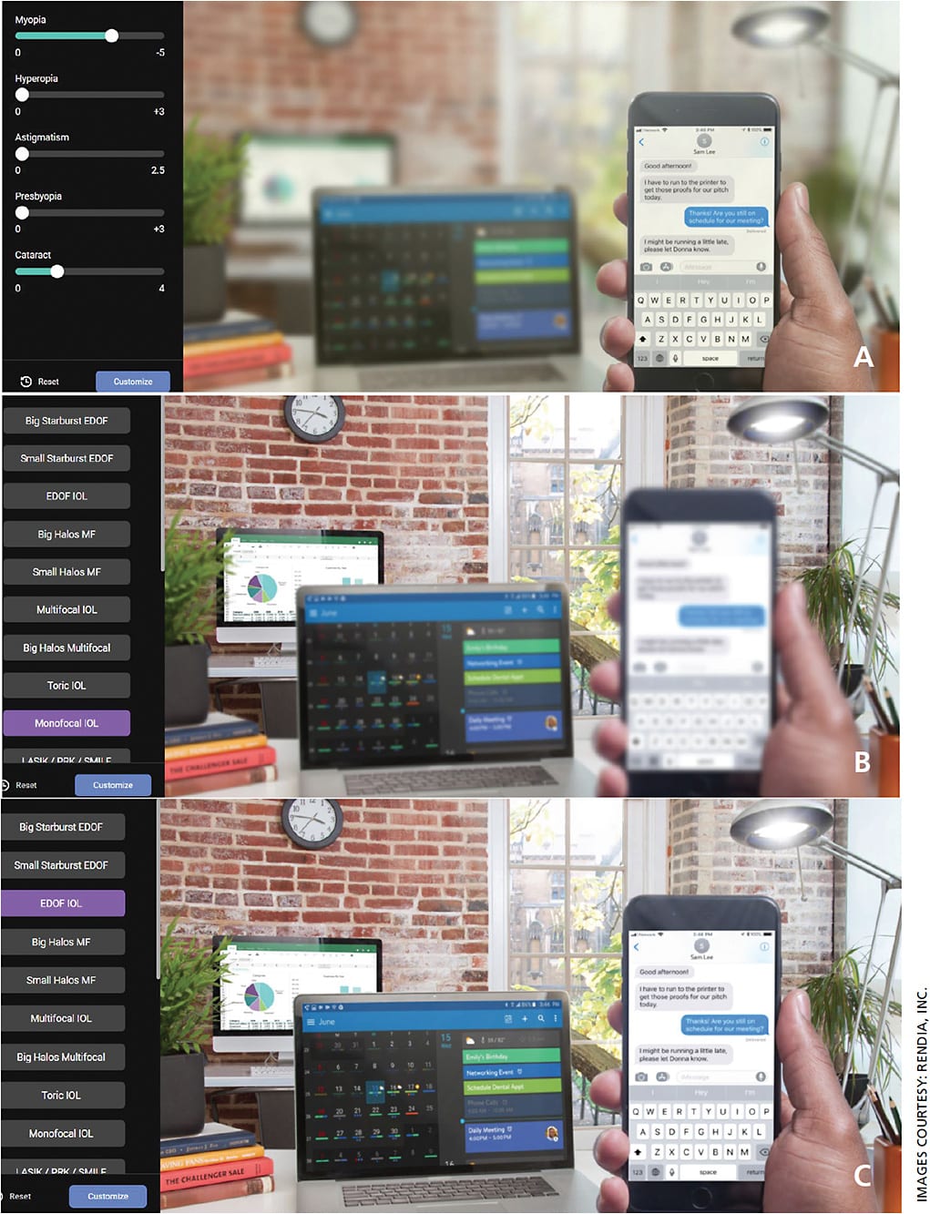 Figure 4. A. Myopic vision with cataract simulator. Simulation of mild cataract in the myopic patient demonstrating ability to still read cell phone without glasses. B. “Insurance covered” IOL simulator. Simulation demonstrating blurred near vision without glasses following implantation of standard monofocal IOL. C. EDOF IOL simulator. Simulation of useful near and excellent intermediate and distance vision without glasses following implantation off EDOF IOL.