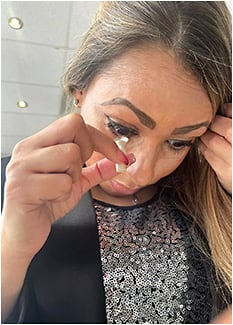 Figure 3. Tucking the chin into the chest while inserting a scleral lens assists in the angle of insertion to minimize air trapped between the lens and the eye.