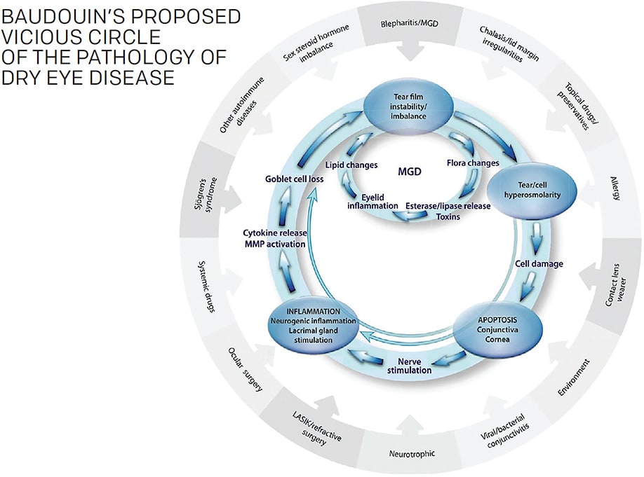 Figure 2. Baudouin illustrates that meibomian gland dysfunction is the prominent actor in ocular surface disease.