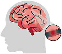 piyaphat/stock.adobe.com