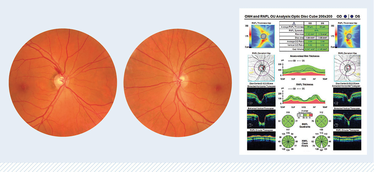 Images courtesy of Dr. Austin Lifferth.