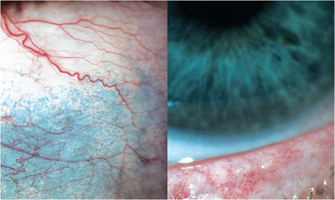 Photos courtesy of Whitney Hauser, O.D.