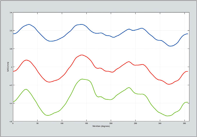 Figure 4: Non-toric asymmetric sagittal height plot from Figure 3 elevation map