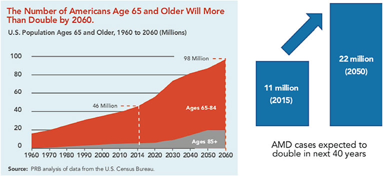 Figure 1. AMD is on the rise, and the number of cases is expected to increase.