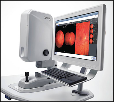 IMAGE COURTESY CARL ZEISS MEDITEC