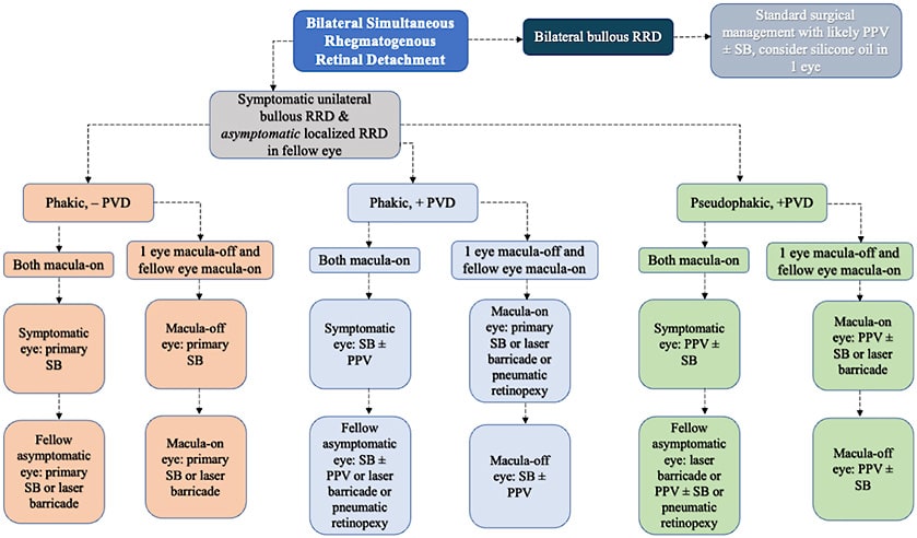 Figure 3. Schematic of our surgical approach for bilateral simultaneous rhegmatogenous retinal detachments