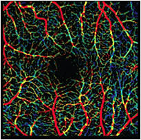 Figure 2. 3 mm x 3 mm scan full retina segmentation of a normal eye imaged on an SS-OCTA prototype device with subsequent processing by the variable interscan time analysis (VISTA) algorithm. VISTA processing was applied to a 3 mm x 3mm SS-OCTA scan to obtain a color-coded map of relative flow speeds. Red indicates faster relative flow, while blue indicates slower relative flow.