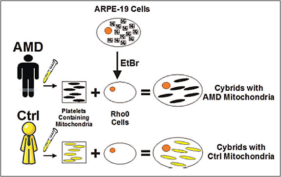 Figure 1. Schematic drawing for creation of transmitochondrial cybrids by fusion of platelets (originating from AMD or control subjects) with RPE cells devoid of mitochondrial DNA.
