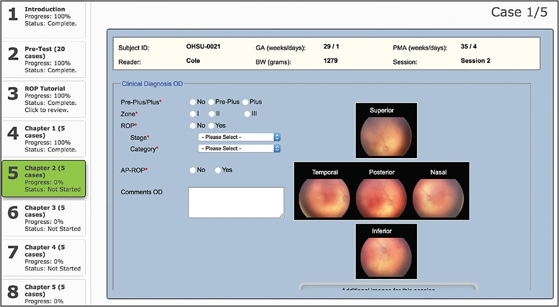 Figure 1.  Web-based retinopathy of prematurity learning interface.