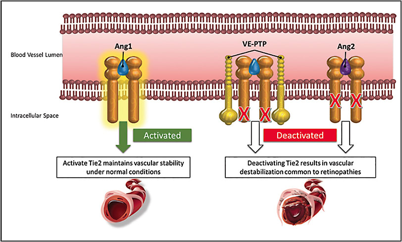 Figure 1. The Tie2 receptor in normal (phosphorylated, stable) and pathologic (dephosphorylated, destabilized) vasculature. In normal vessels (left), Ang1, originating largely from periendothelial cells (pericytes and smooth muscle cells), maintains Tie2 activation and vascular stability. In diseased vessels (right), as in the diabetic retina, Ang2 and VE-PTP are increased, leading to Tie2 inactivation and destabilized vasculature predisposed to vascular leakage and pathologic angiogenesis.