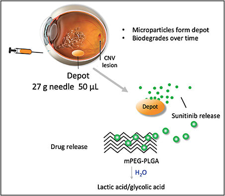 Figure 1. GB-102 is a depot of PLGA microparticles containing sunitinib.