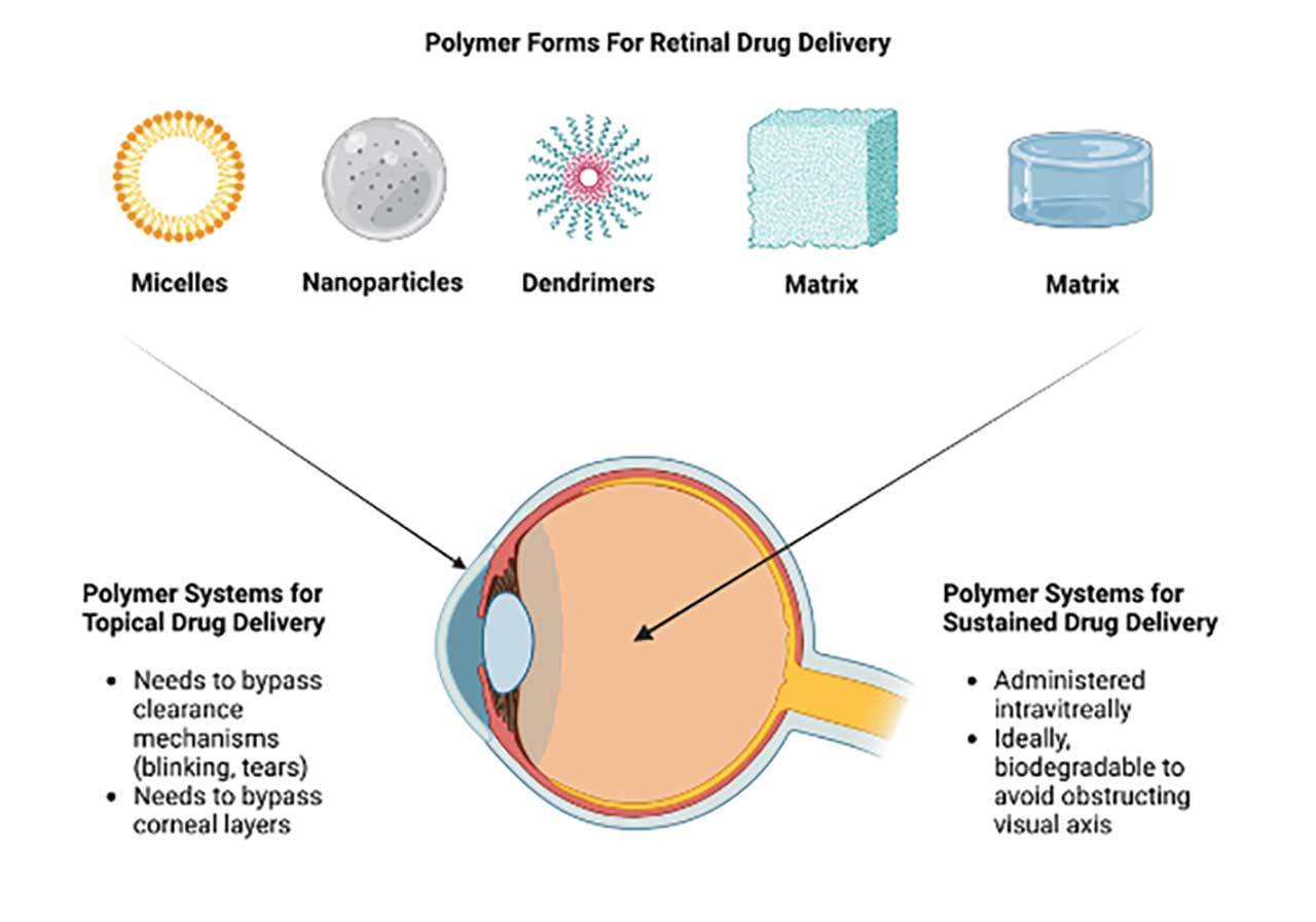 Figure 1.  Types of polymer platforms for retinal drug delivery.
