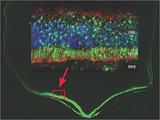Figure 1. Widespread expression of green fluorescent protein (GFP) in retinal pigmented epithelium (RPE) and photoreceptors after suprachoroidal injection of AAV8.GFP. Two weeks after suprachoroidal injection of 3 µl containing 2.85 x1010 genome copies of AAV8.GFP, a transverse ocular section at the level of the equator showed fluorescence from GFP expression in the retina and RPE. The fluorescence was very strong on the side of the eye in which the injection was done, but fluorescence was detectable around the entire circumference of the eye. High magnification view of the boxed region of the section that is stained with an antibody directed against GFP (red) showed that the GFP was present in the RPE (partially separated in this location), photoreceptor inner segments (IS) and outer segments (OS) and some photoreceptor cell bodies in the outer nuclear layer (ONL). The nuclei of the photoreceptors are stained blue.
