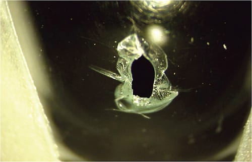 FIGURE 8. The hole in the lens absorbed the impact and protected the cornea from further damage. Examination of the lens revealed a 1mm x 2mm full-thickness hole and at higher magnification showed relatively clean edges and minimal adjacent lens cracking. Image courtesy of Maria Walker, OD.