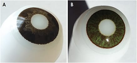 Figure 4. A custom brown prosthetic lens (A) and a custom green prosthetic lens (B).