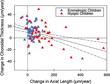 Figure 3. The relationship between changes in choroidal thickness and the rate of axial eye growth in childhood.11 Note the significant inverse relationship between the changes in choroidal thickness and axial length, with more rapid eye growth associated with a thinning of the choroid.