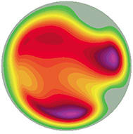 FIGURE 2: Ablate the purple areas. IMAGE COURTESY MARK LOBANOFF, MD