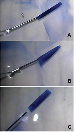 FIGURE 3: Manipulation of non-preloaded DMEK tissue. A: Inserting cannula within center of scroll. B: Injection: C: Double scroll confirmation. IMAGE COURTESY LAURA PALAZZOLO, MD, &amp; DEEPINDER K. DHALIWAL, MD, L.AC
