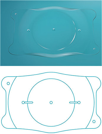 Visian Toric ICL top; EVO+ bottom. IMAGE COURTESY STAAR SURGICAL
