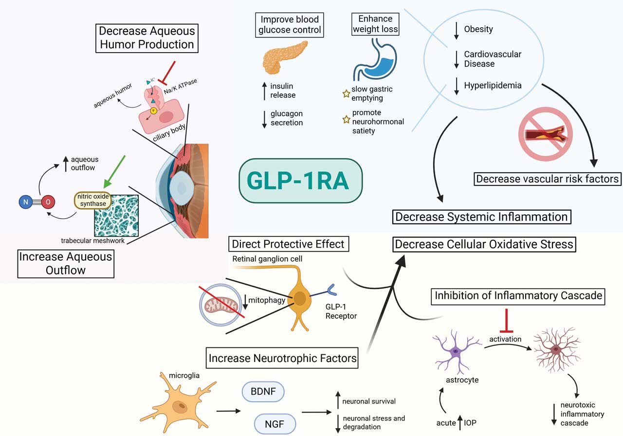<p><strong>Figure 1.</strong> Proposed ocular and systemic mechanisms of glucagon-like peptide 1 receptor agonists (GLP-1RAs).</p>