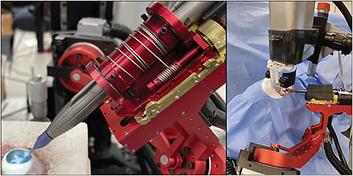 Figure 2. The Intraocular Robotic Interventional Surgical System.