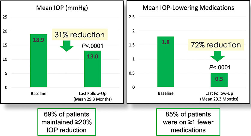 Figure 1. Long-term follow-up of Kahook Dual Blade (New World Medical) goniotomy with cataract surgery illustrates that 69% of patients maintained greater than or equal to 20% reductions in IOP at 29.3 months — with a range of 22 months to 35 months — postoperatively.10