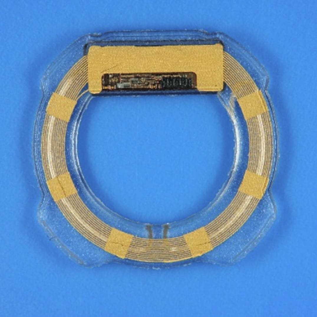 Figure 2. The Eyemate-IO (Implandata Ophthalmic Products). Source: Choritz et al.6