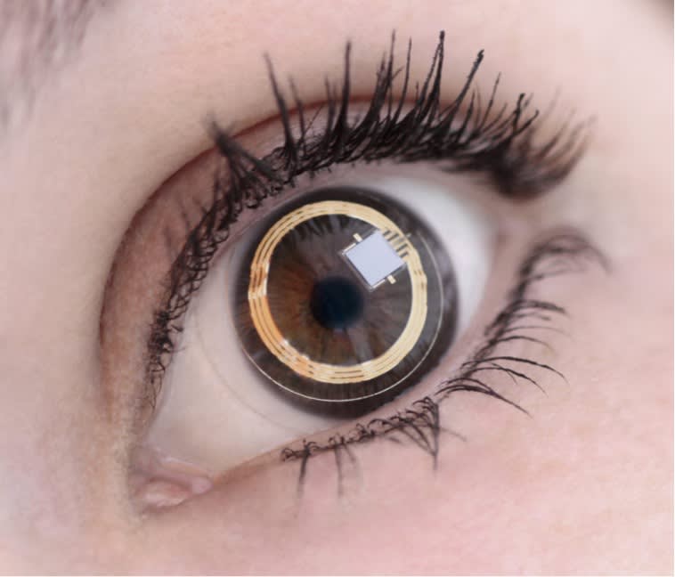 Figure 1. The Triggerfish contact lens sensor (Sensimed). Source: https://sensimed.ch/sensimed-triggerfish