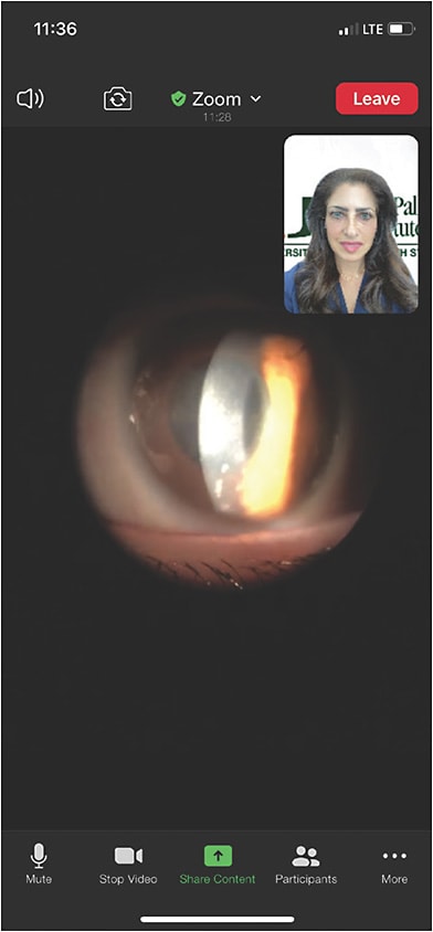 Dr. Rayna Habash evaluates, via video slit lamp examination, her patient in a hybrid telemedicine visit.COURTESY DR. RAYNA HABASH