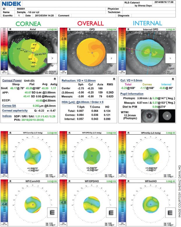 Figure. OPD-Scan III (Nidek) Daya overview