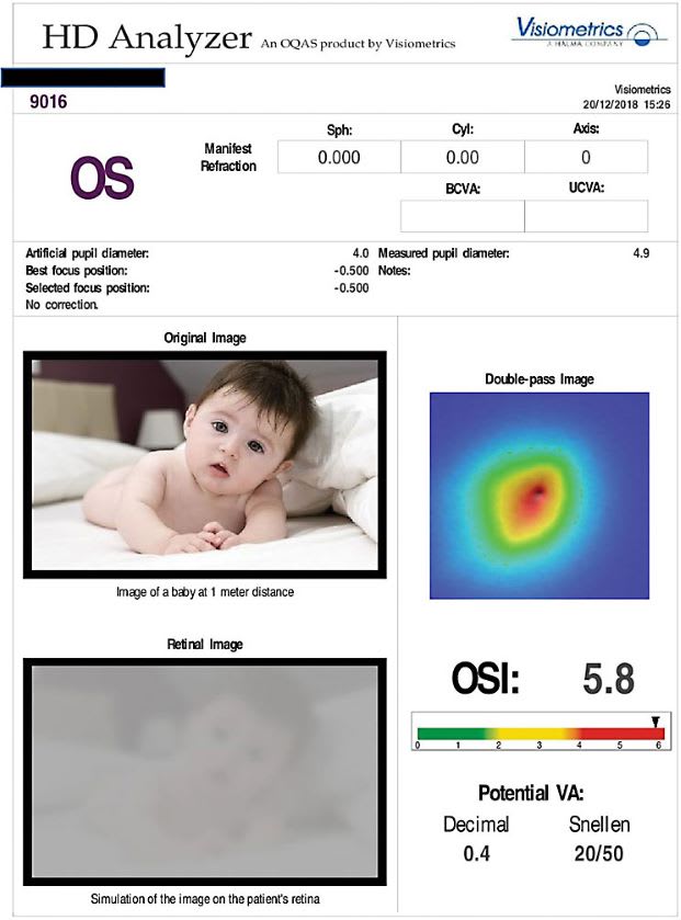 Figure 2a