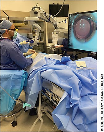 Dr. Hura performing ICL surgery using 3D heads-up display technology.