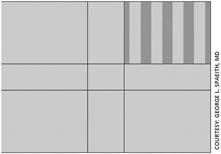 Figure 3. SPARCS measures contrast sensitivity in one central and four peripheral areas. Vertical contrast gratings of varying intensities are presented in each area.