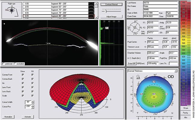 FIGURE 2. Sample image showing “raw” Scheimpflug capture