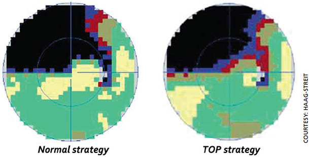 Figure 1. Comparison of standard perimetry and Tendency-Oriented Perimetry (TOP). Scotomas in TOP tend to be shallower, with reduced spatial resolution due to the spread of answers over neighboring test locations. There was no statistically significant difference in reproducibility between the two.