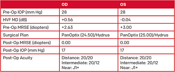 FIGURE 3. Patient summary preop and postop with bilateral implantation of a PanOptix IOL and Hydrus Microstent