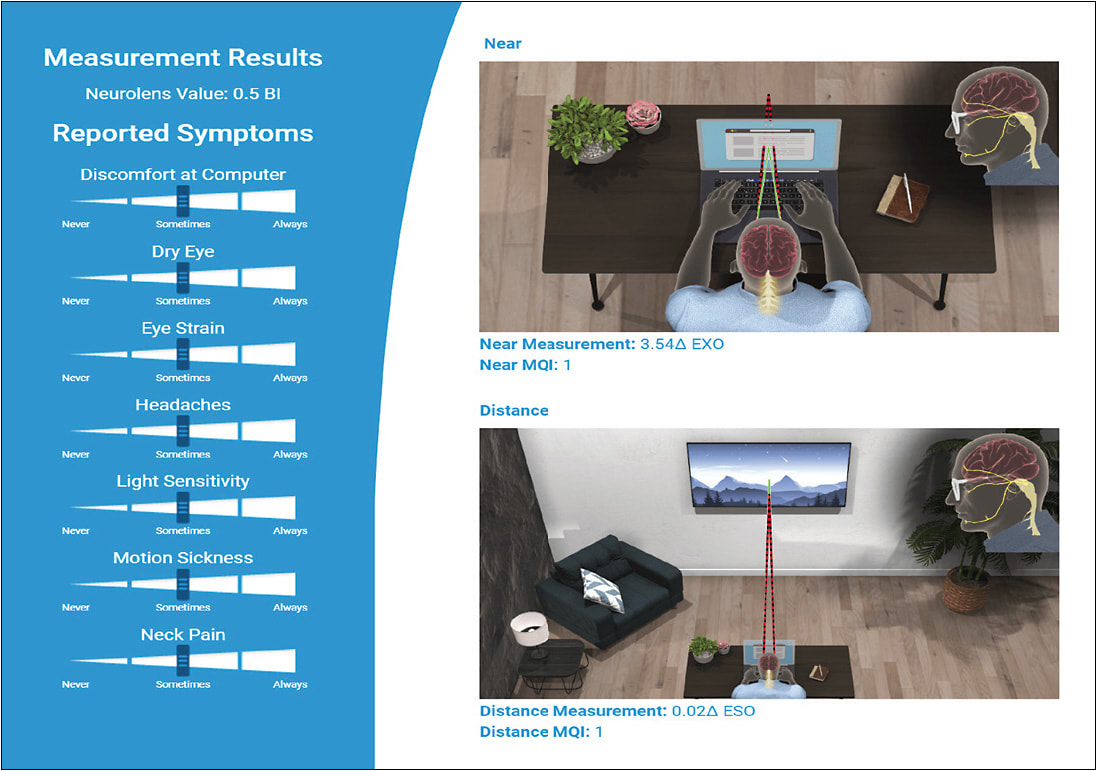 Figure 1. The result of a patient’s binocular vision test. Image courtesy of Dr. Richard.