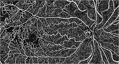 Image courtesy Julie Rodman OD, MSc, FORS, FAAO