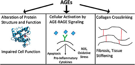 Figure 1. Negative effects of advanced glycation end products (AGEs). AGEs lead to impaired cell function, altered signaling pathways, and increased collagen crosslinking. These processes, particularly crosslinking, are responsible for stiffening of the sclera and other ocular structures with age. (Adapted from Roorda MM. Therapeutic interventions against accumulation of advanced glycation end products (AGEs). Glycative Stress Research 4(2): 132-143, 2017).
