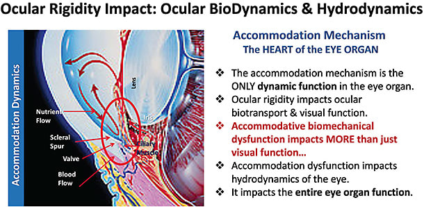 Figure 3. Aqueous humor circulation and the important relationship between accommodation and hydrodynamics. (Adapted from Krey HF, Bräuer H. 1998. Chibret Augenatlas: Eine Repetition für Ärtze mit Zeigetafeln für Patienten. Munich: Chibret Med Serv).