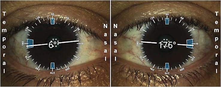 Figure 3. Biometry